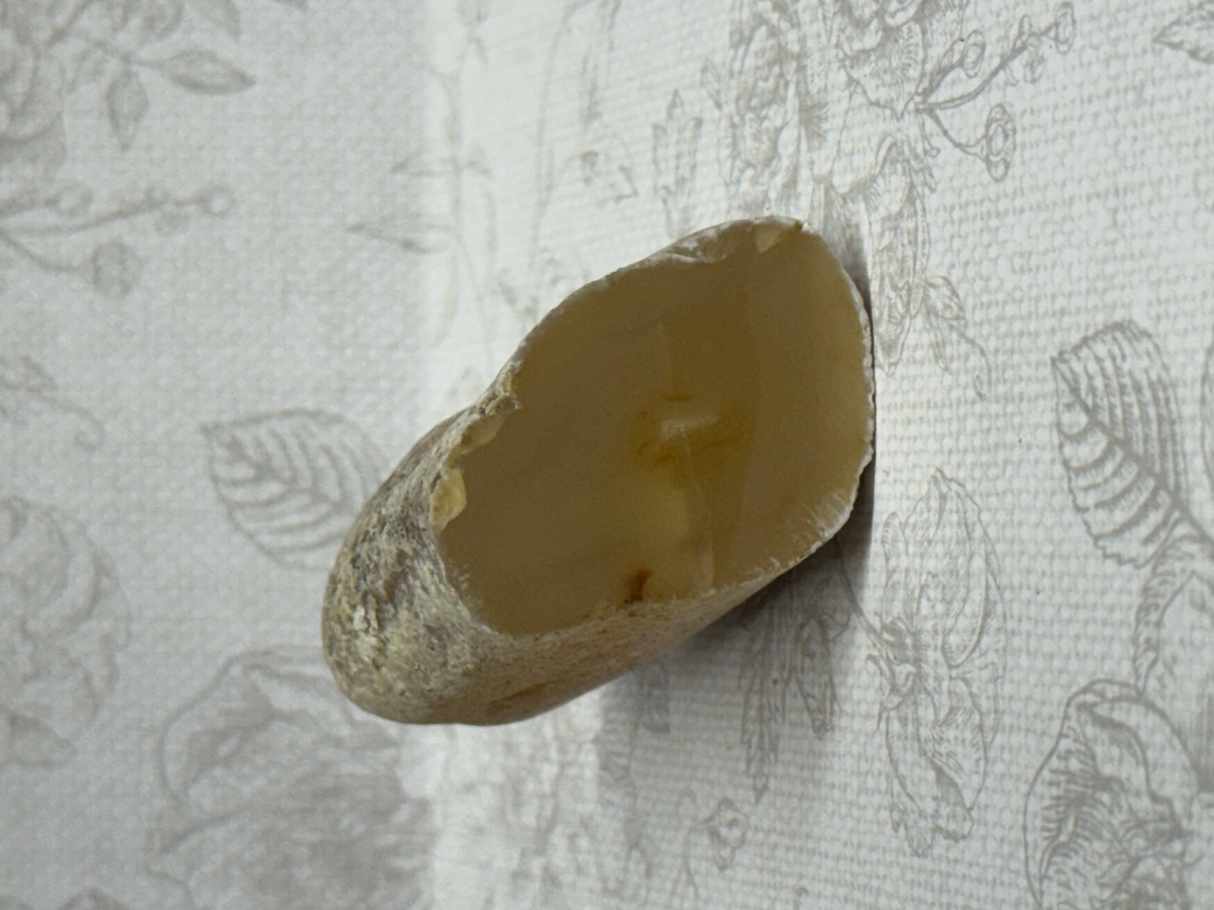 Agatized limb cast angle 2